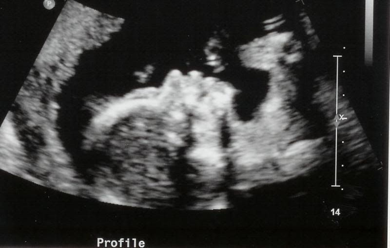 Proflie new human #2