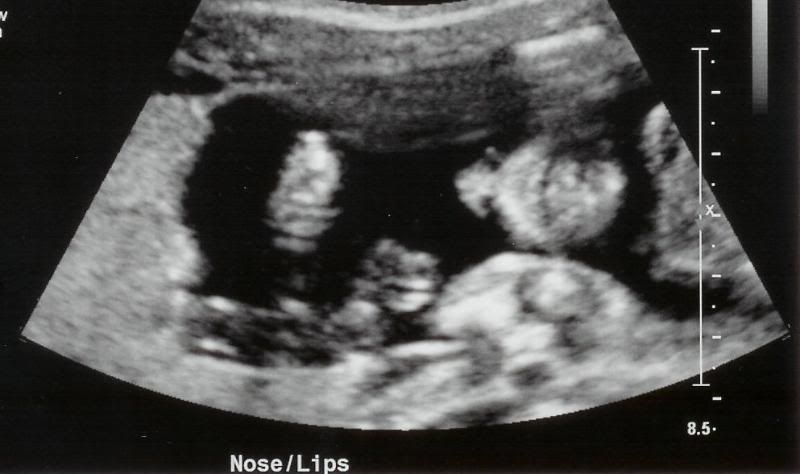 New Human #2 Nose/Lips