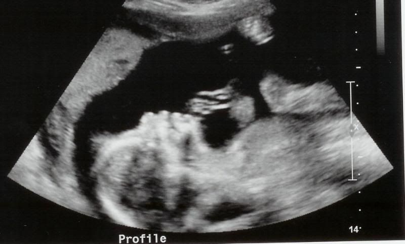 Other profile new human #2